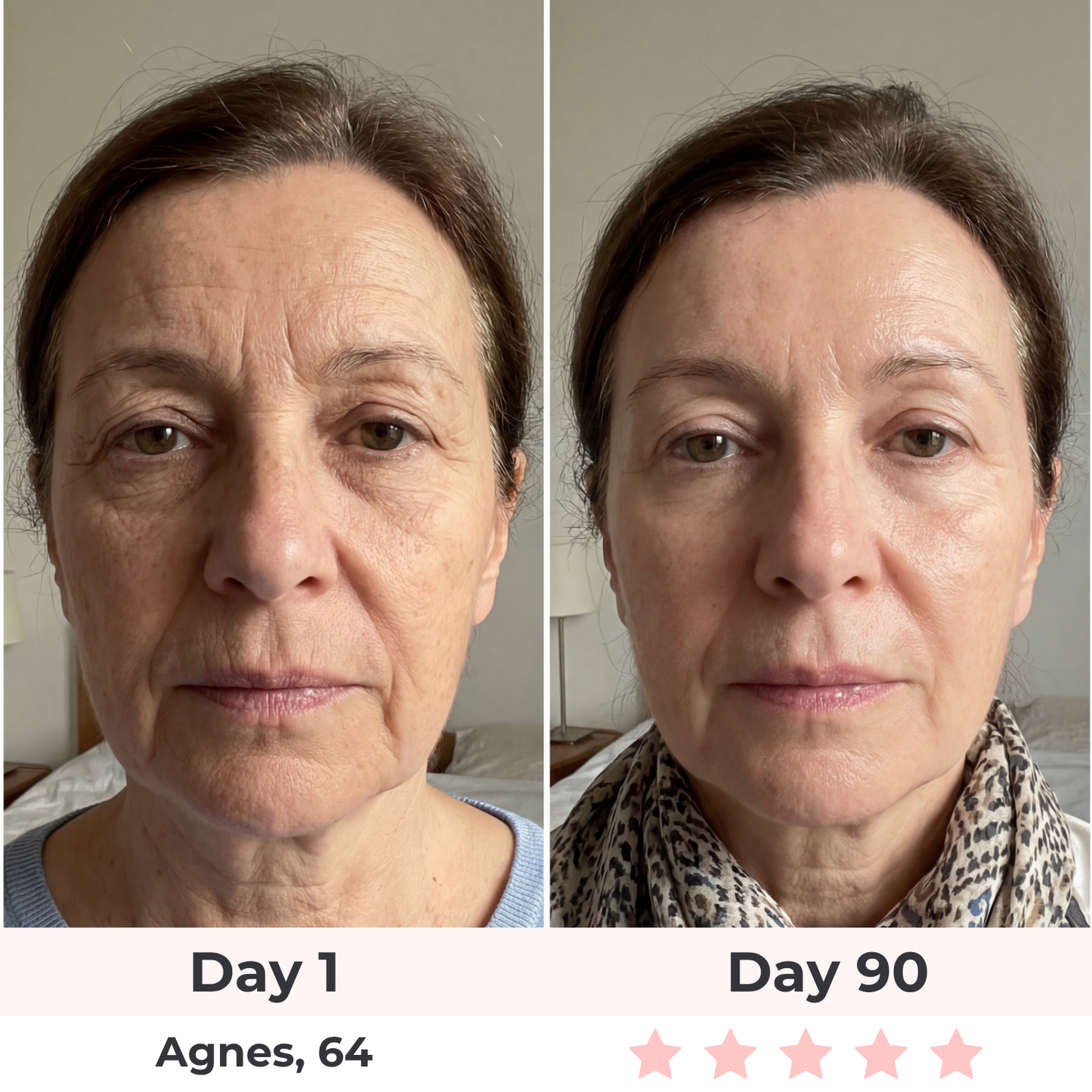 Beautyvelle 7-in-1 LED Face Mask