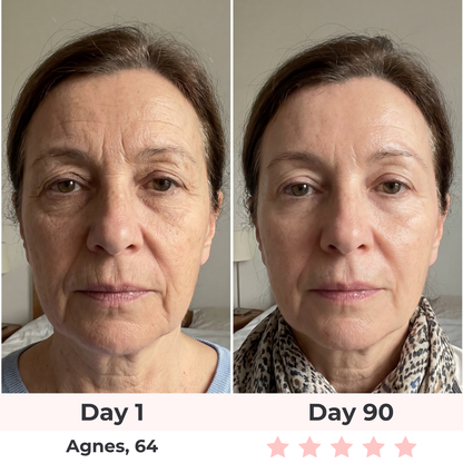 Beautyvelle 7-in-1 LED Face Mask