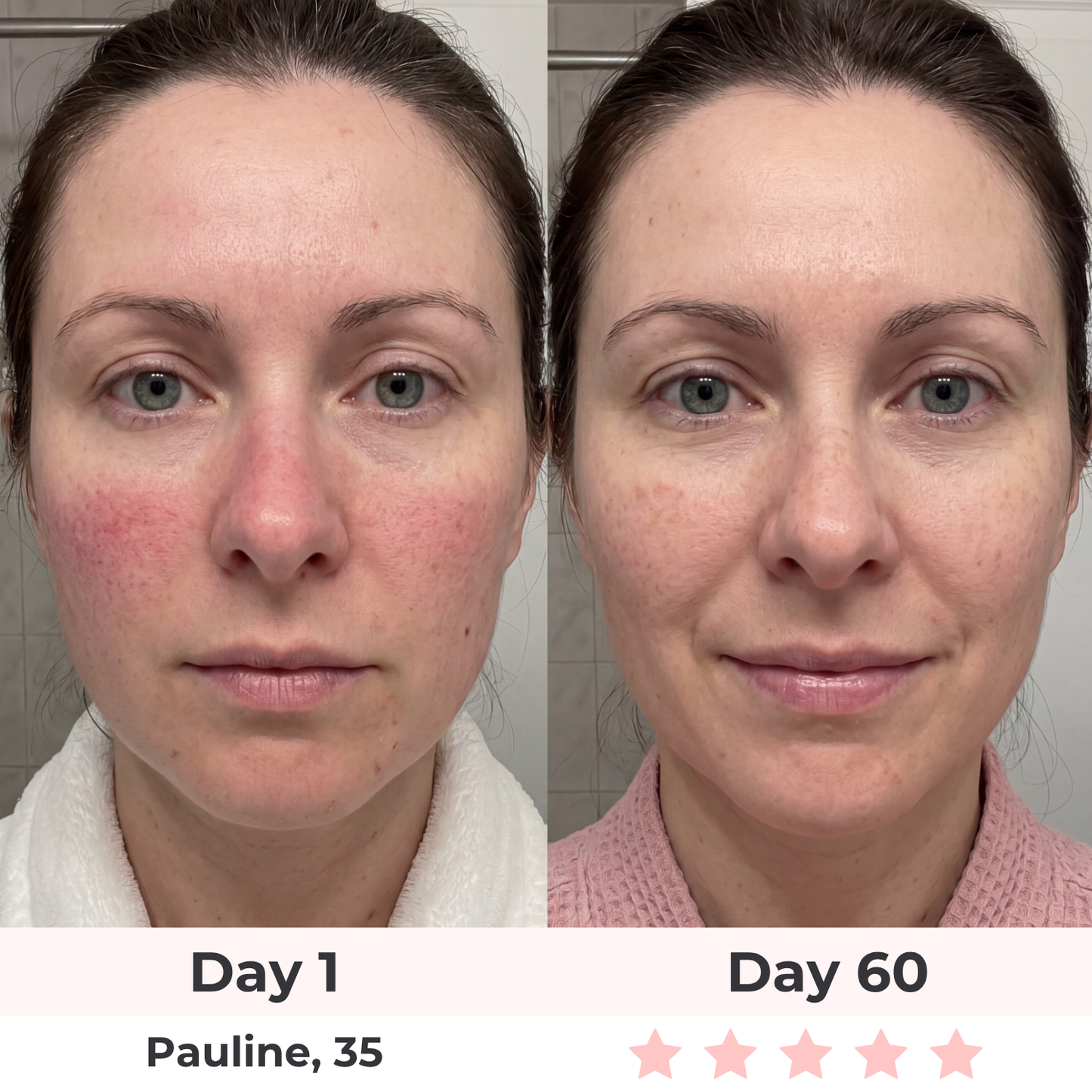 Beautyvelle 7-in-1 LED Face Mask