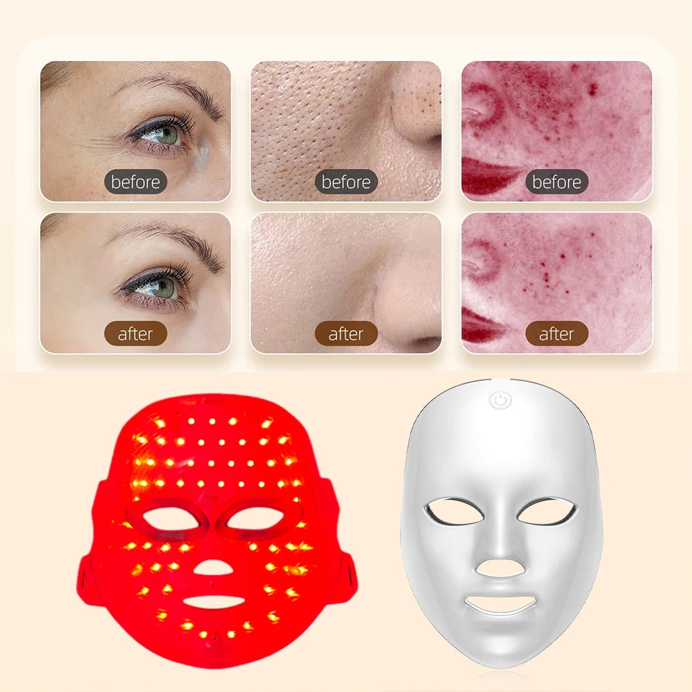 Beautyvelle 7-in-1 LED Face Mask