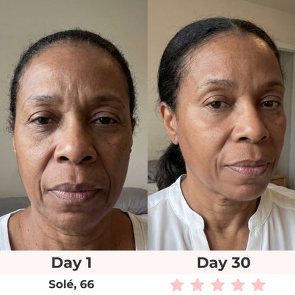Beautyvelle 7-in-1 LED Face Mask