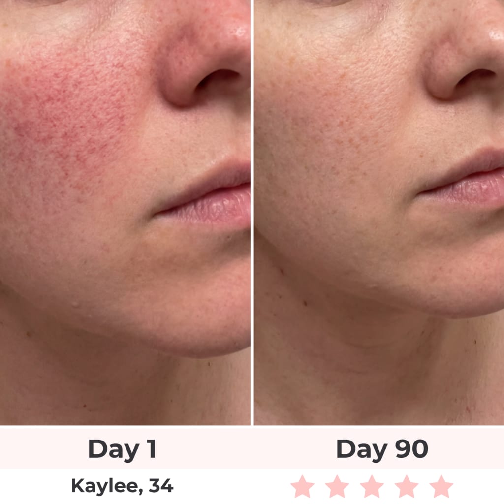 Beautyvelle 7-in-1 LED Face Mask