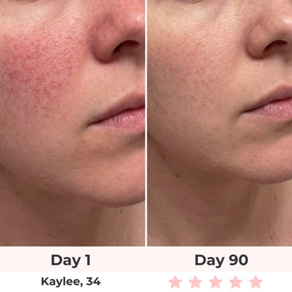 Beautyvelle 7-in-1 LED Face Mask