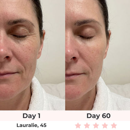 Beautyvelle 7-in-1 LED Face Mask