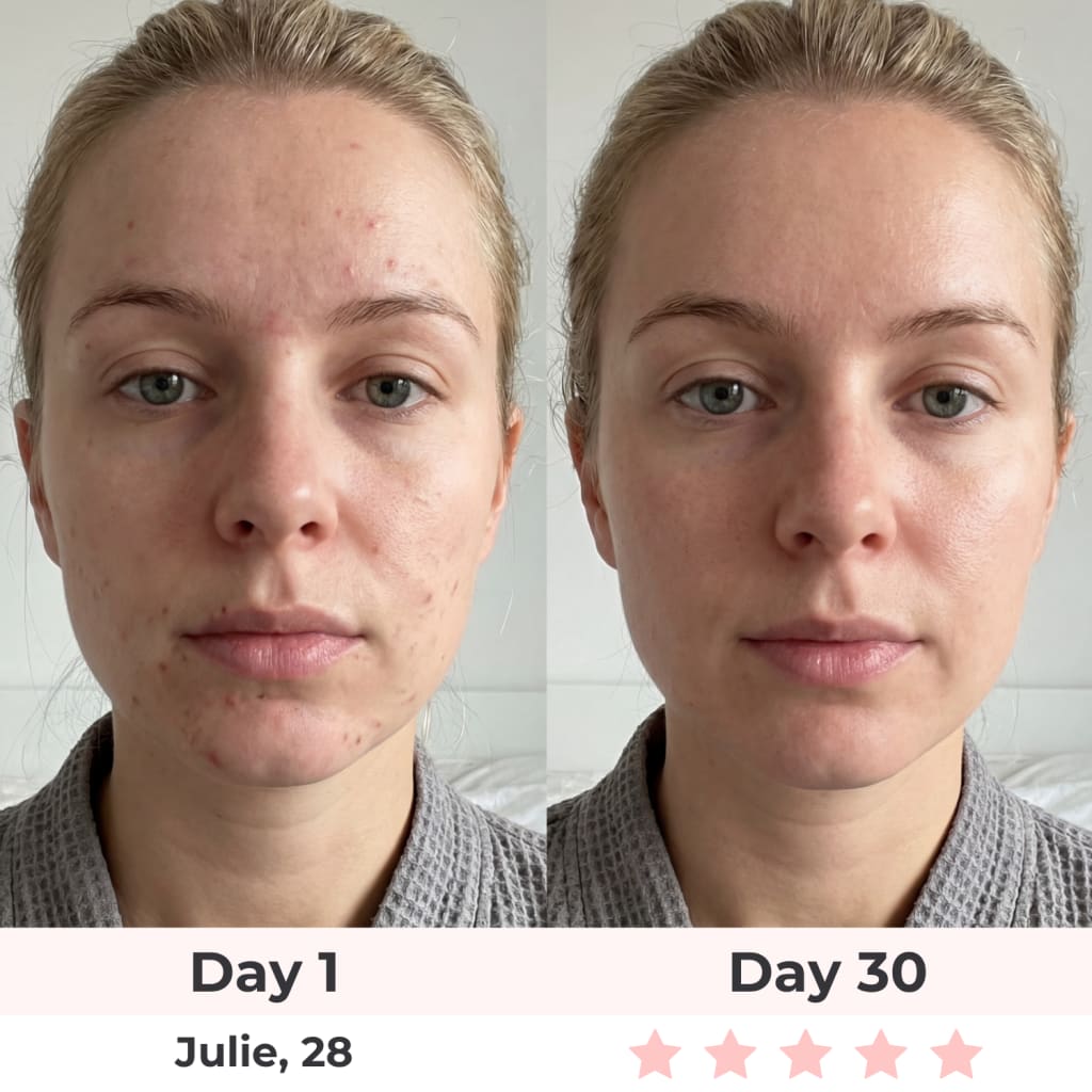 Beautyvelle 7-in-1 LED Face Mask