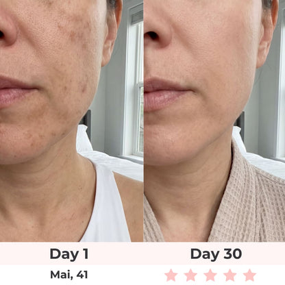 Beautyvelle 7-in-1 LED Face Mask